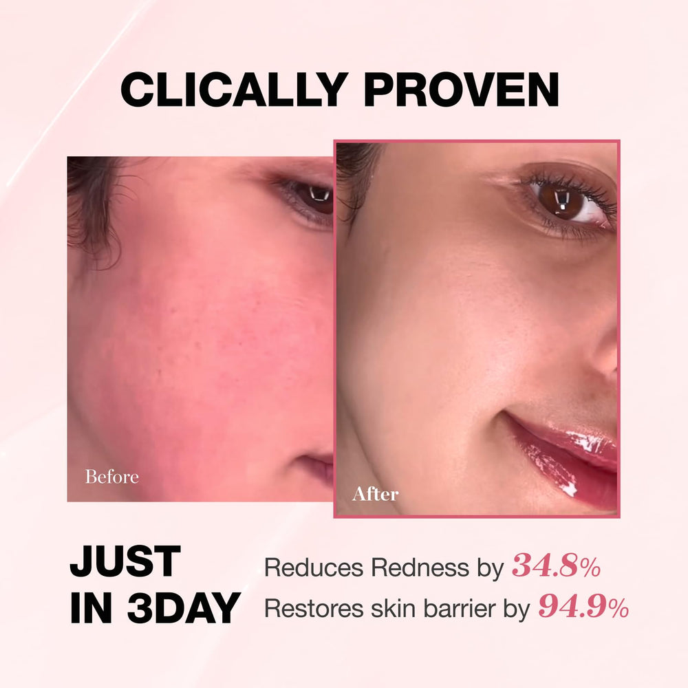 PHYSIOGEL cream texture close-up shows smooth formula.