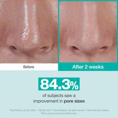 Close-up of the serum texture gliding smoothly onto the skin.