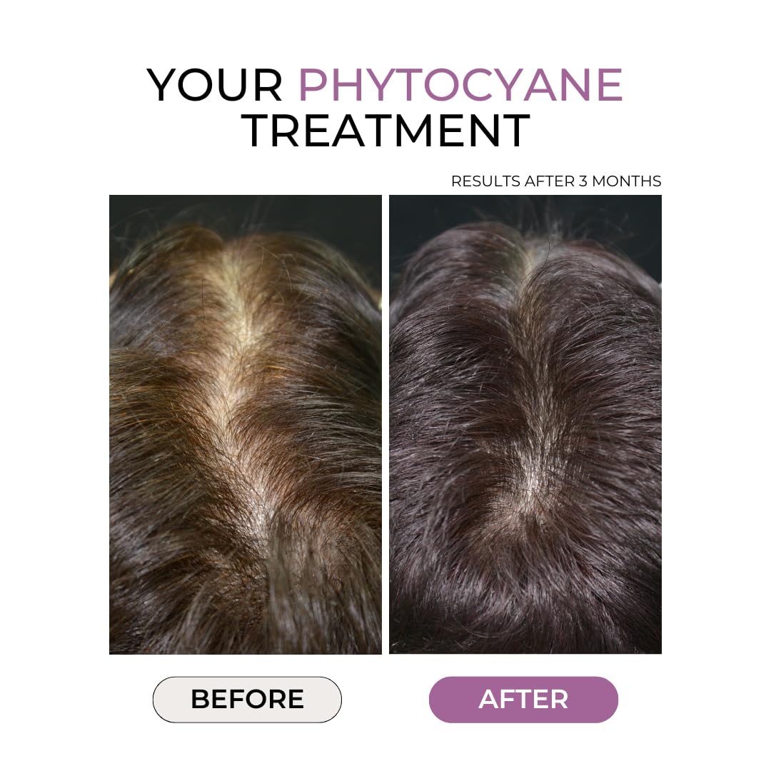 PHYTOCYANE daily dosage image showing one capsule per day for consistent use.