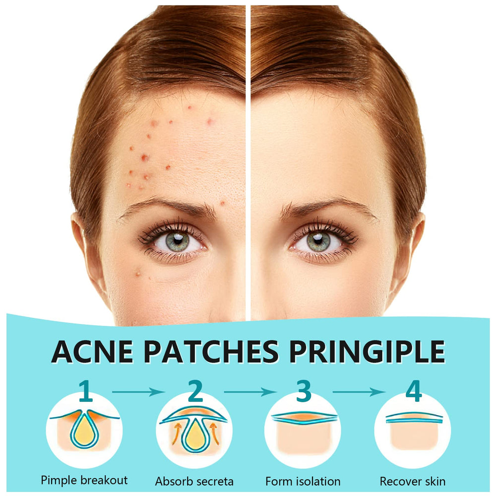 PICcircuit invisible matte patches applied discreetly during makeup for blemish coverage.