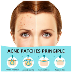 PICcircuit invisible matte patches applied discreetly during makeup for blemish coverage.
