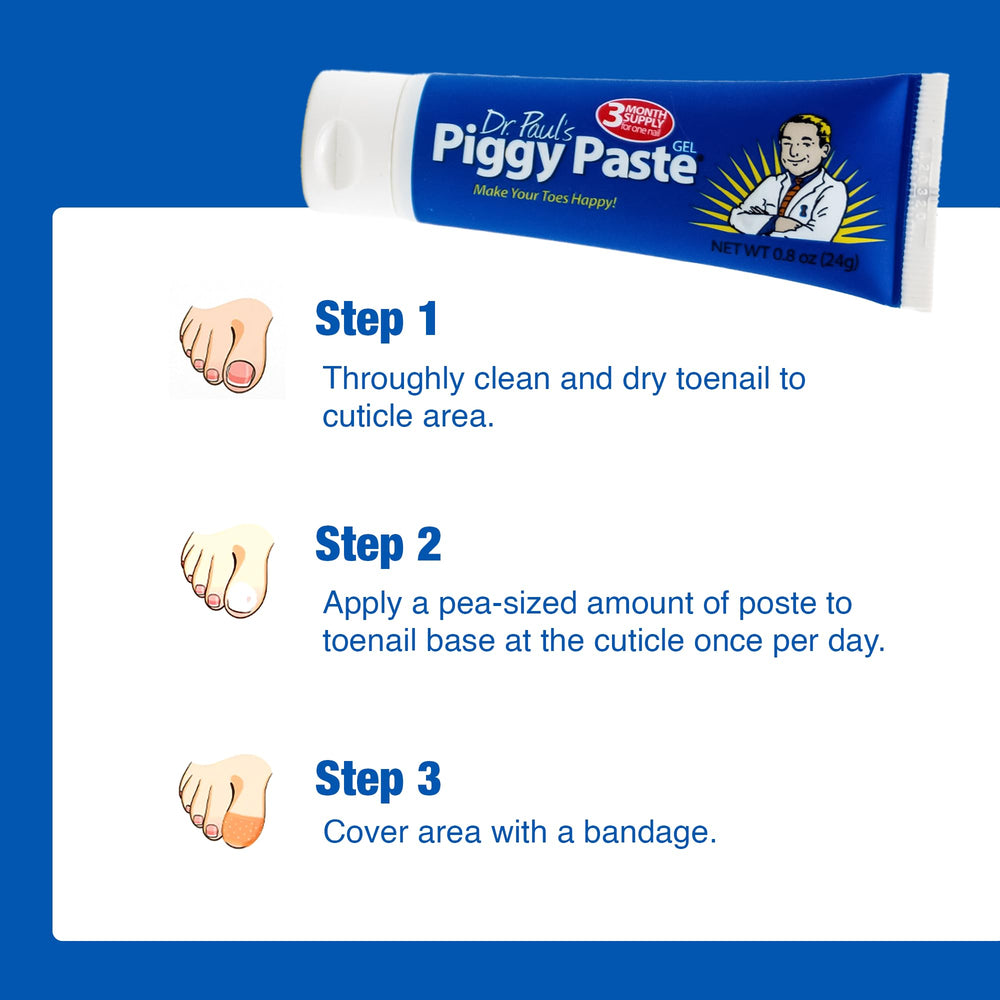 Piggy Paste Gel applied on nail surface for targeted root care