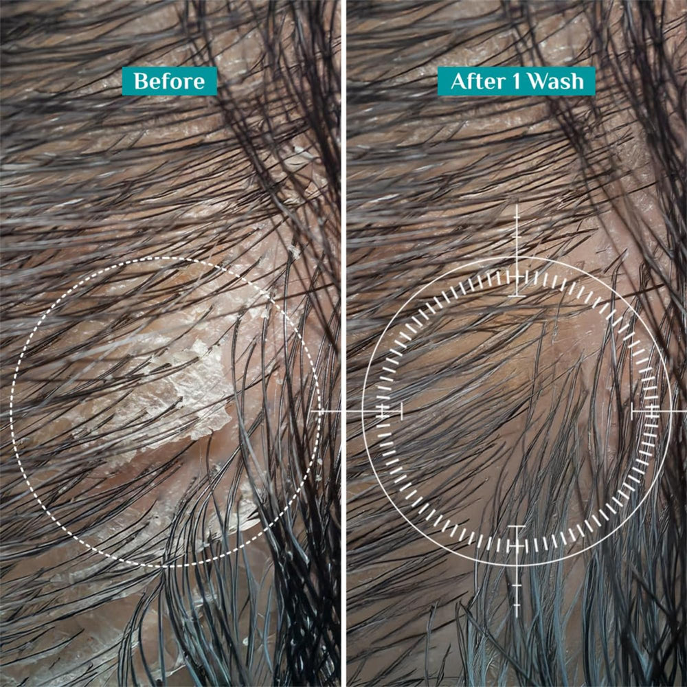 Pilgrim Tea Tree Shampoo hair before and after to visualize revitalized look.