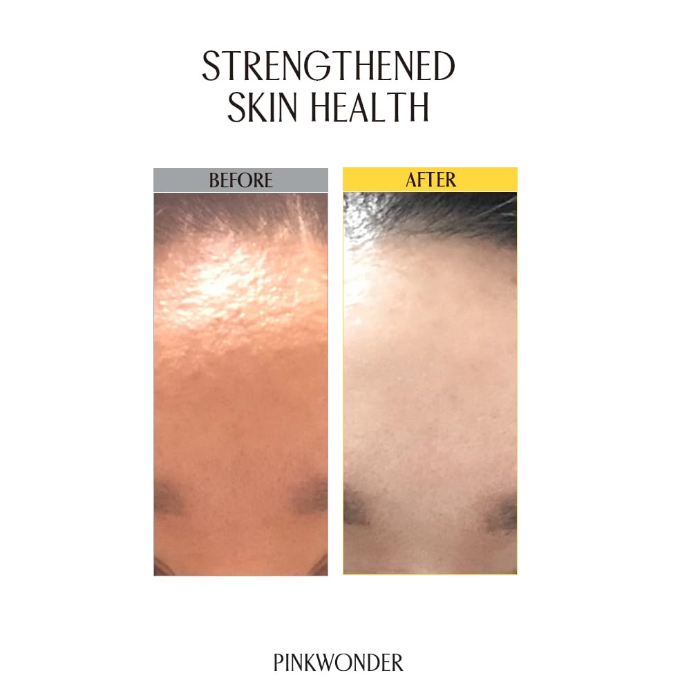 PINKWONDER Jojoba Barrier Plus Cream label view with clean, hypoallergenic branding.