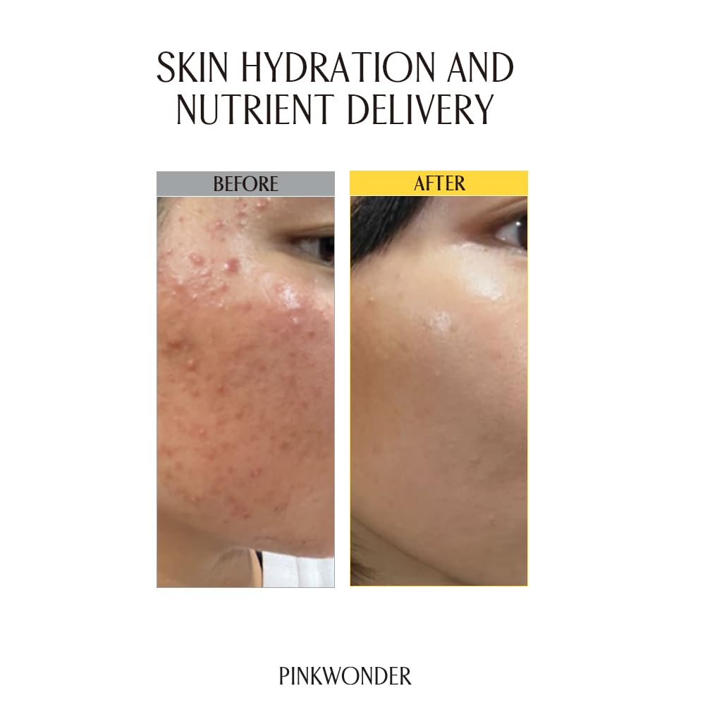 PINKWONDER Jojoba Oil Toner golden oil drop signaling deep hydration