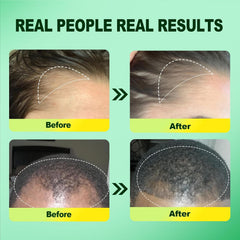 Pipuxi 5% Minoxidil women bottle for easy application and potential regrowth support.