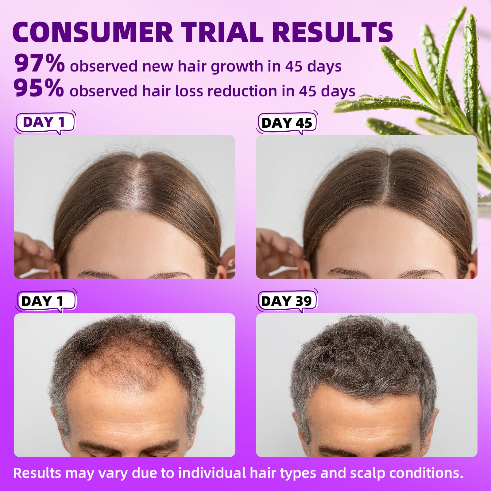 Pipuxi minoxidil spray mist enables quick scalp application with rosemary aroma.