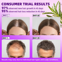 Pipuxi minoxidil spray mist enables quick scalp application with rosemary aroma.