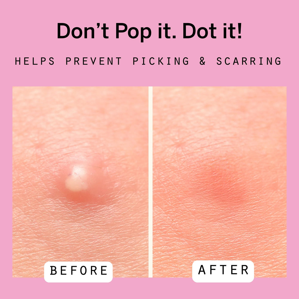 Pixie Cup Dot 8mm patch blends invisibly for day wear