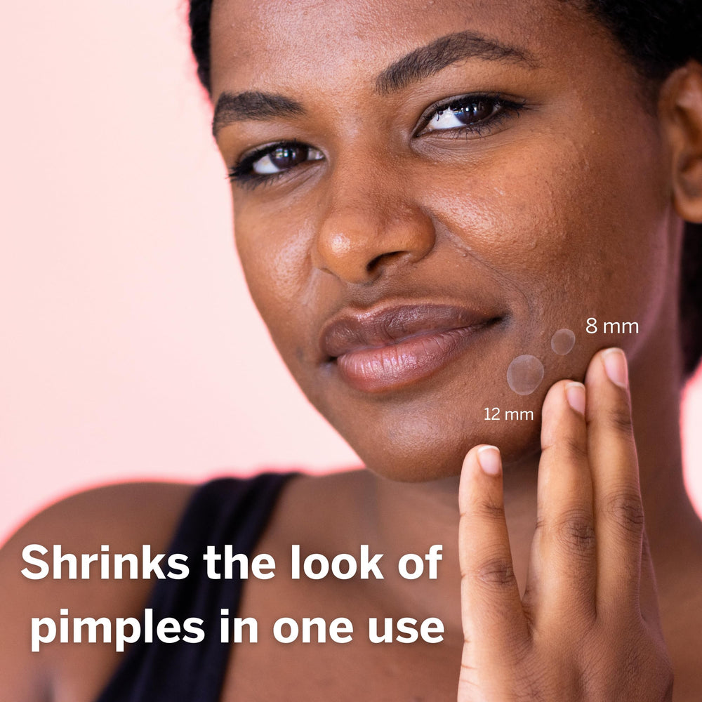 Pixie Cup Dot patch on face offers invisible blemish coverage
