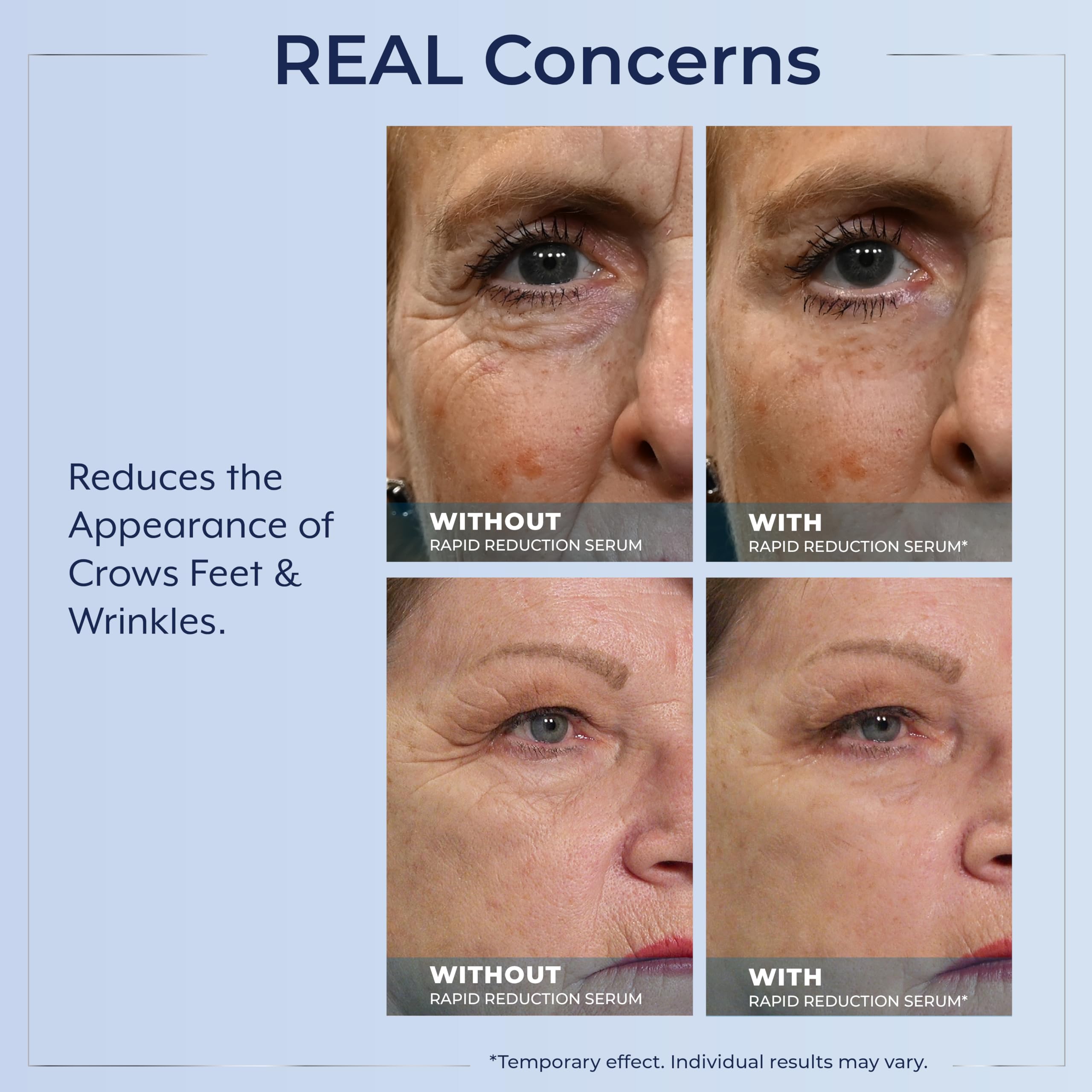 Plexaderm Rapid Reduction Eye Serum during the 10 minute set time.
