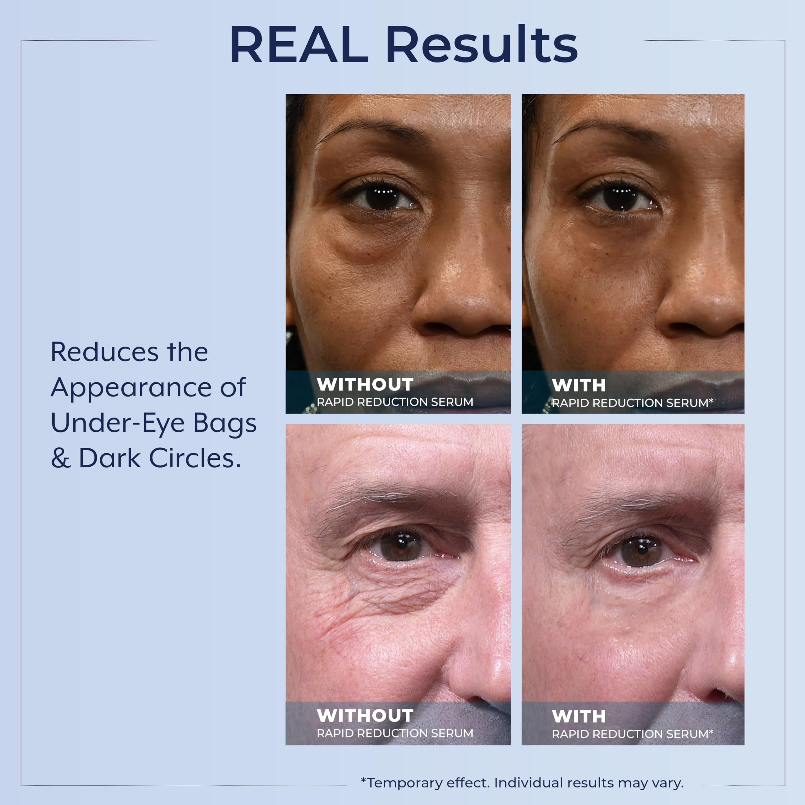 User applying serum on under-eye area before photos.