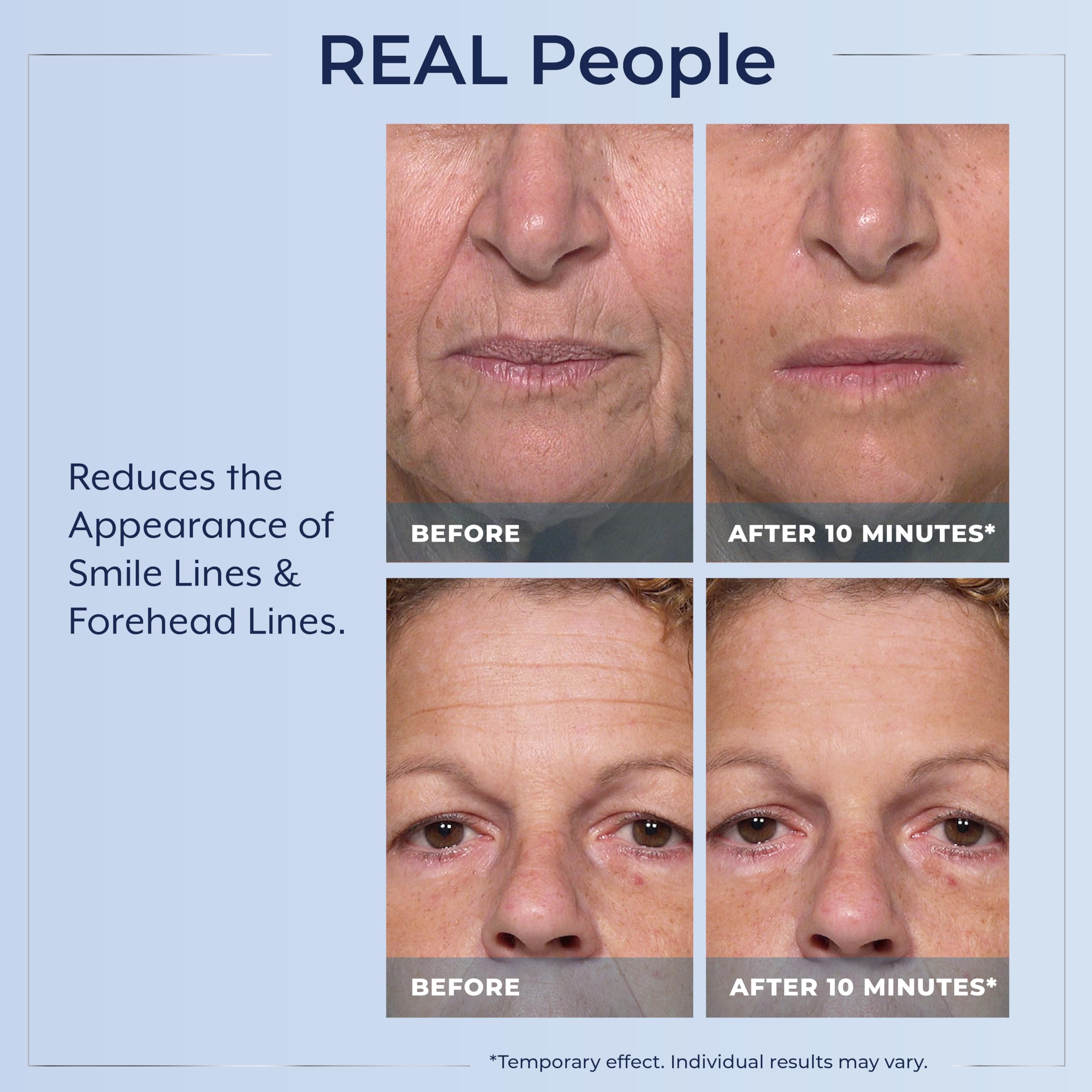 Plexaderm Rapid Reduction Eye Serum applied under-eye area.