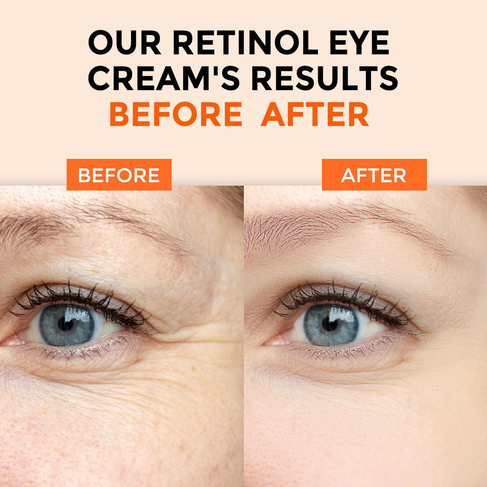 Plus Oneherolabs Eye Cream with Hyaluronic Acid; visual of smooth, hydrated under-eye skin.