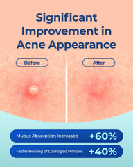 PointMass Pimple Patches two sizes dots fit whiteheads and surface pimples.
