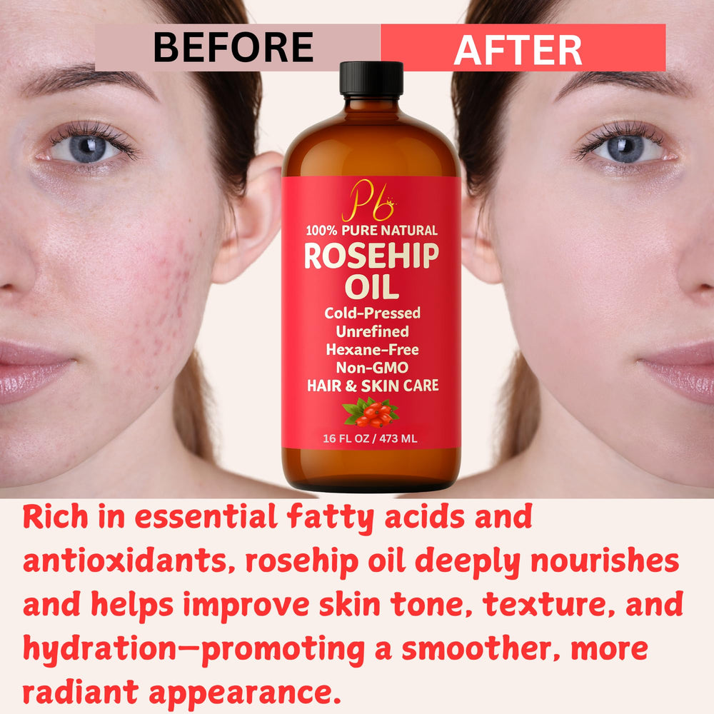 Pomberries Rosehip Seed Oil used as carrier oil in DIY beauty blends.