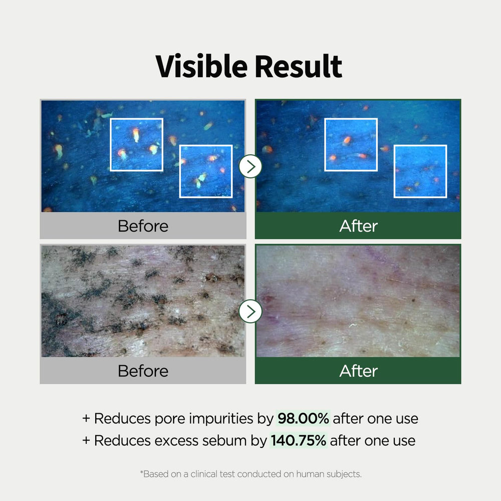 Rinse stage with PONGDANG Pore Deep Clean Oil during cleansing