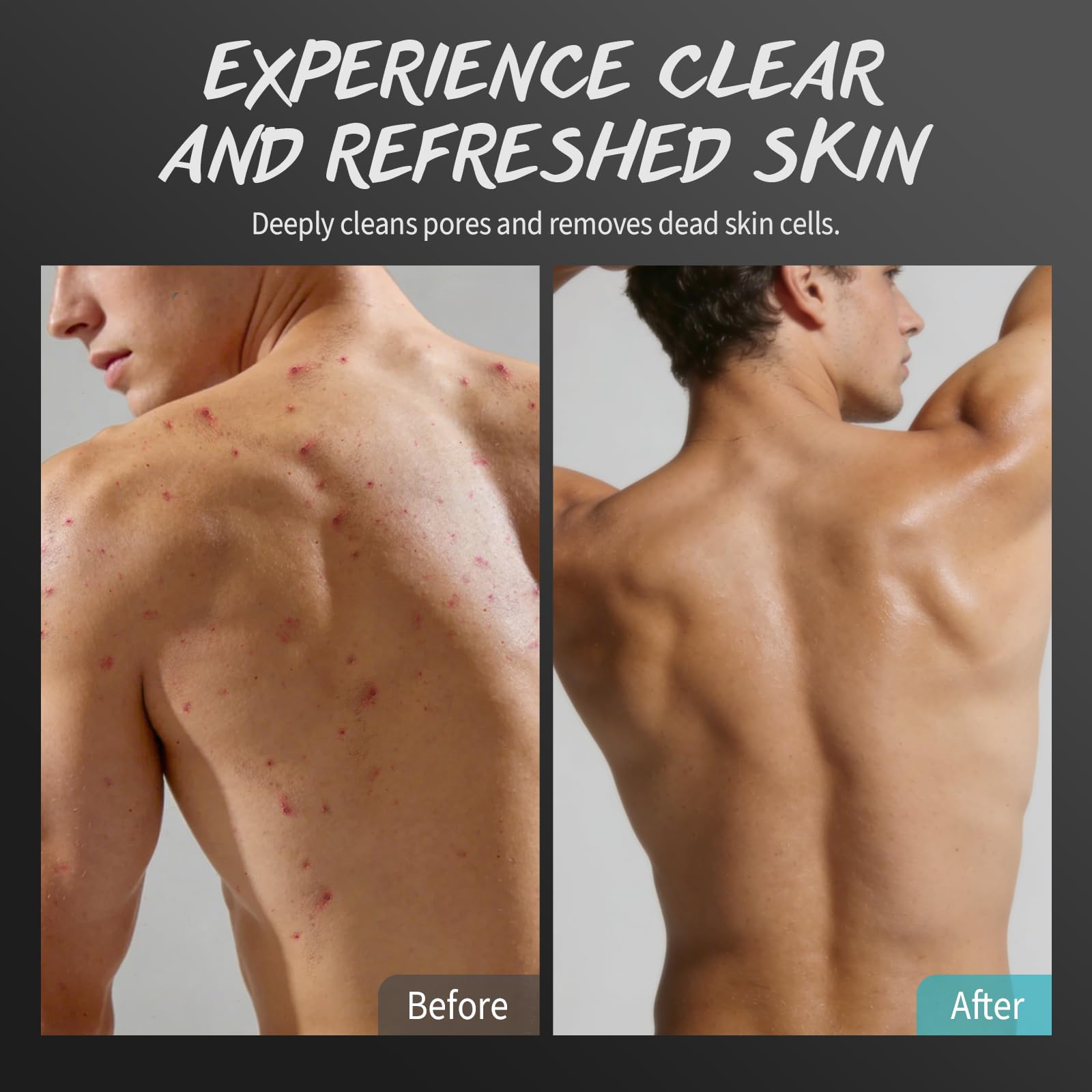 POP MODERN.C Tea Tree Scrub chest glow closeup for smoother texture