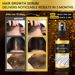 Praiasol Hair Growth Oil Spray applied to the scalp promotes even absorption.