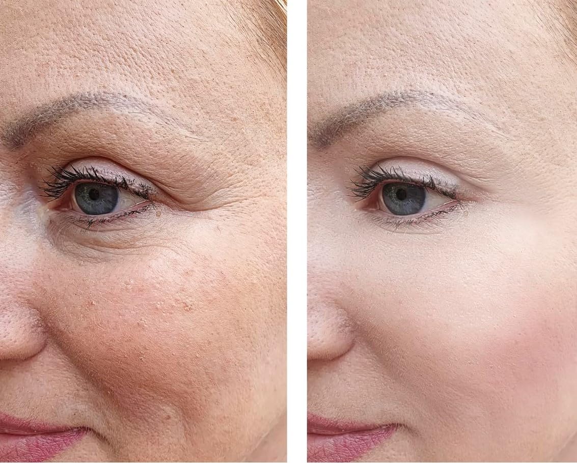 Vitality cream applied on skin for a radiant, refreshed look.