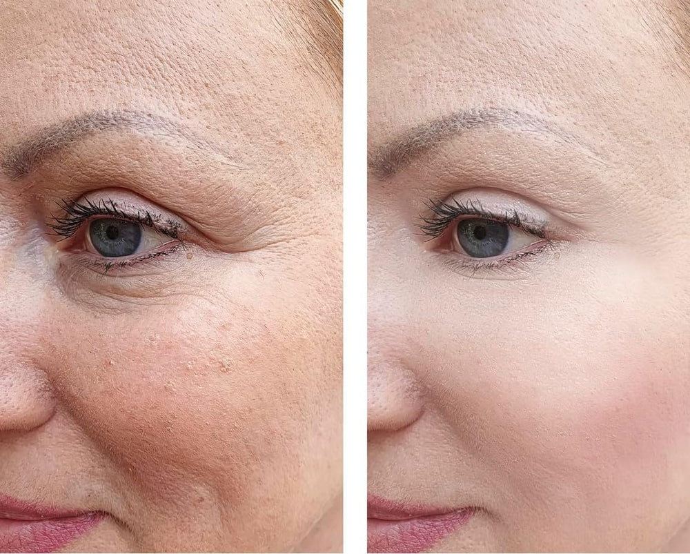 Vitality cream applied on skin for a radiant, refreshed look.
