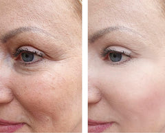 Vitality cream applied on skin for a radiant, refreshed look.
