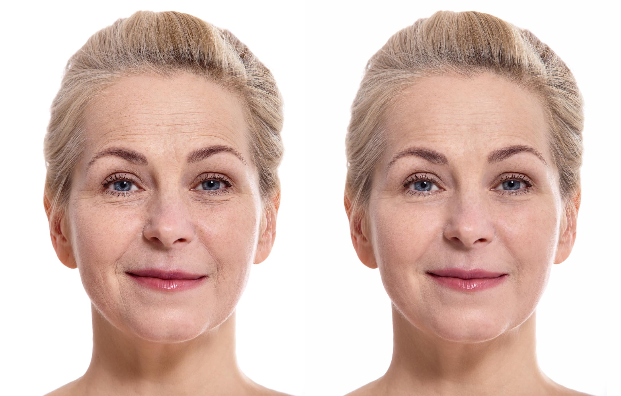 Vitality cream jar close-up highlighting antioxidant-rich formula.