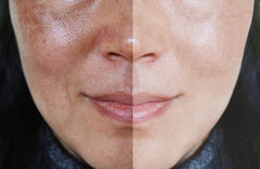 Precision Skin RX Vitality Phloretin C Serum dropper demonstrates easy, controlled application.