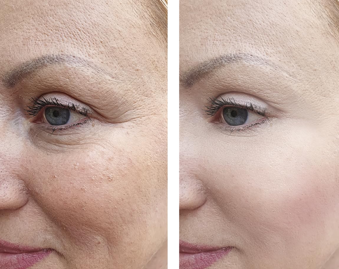 Precision Skin RX Vitality Phloretin C Serum ingredients graphic highlights phloretin benefits.
