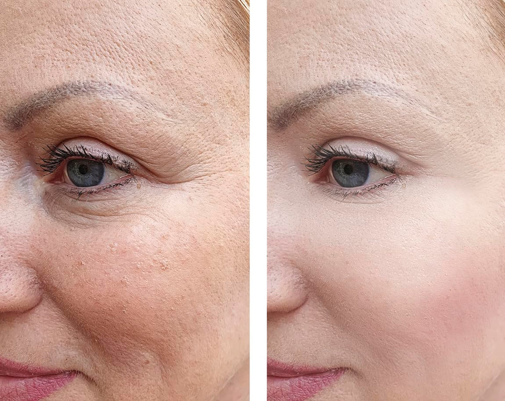 Precision Skin RX Vitality Phloretin C Serum ingredients graphic highlights phloretin benefits.