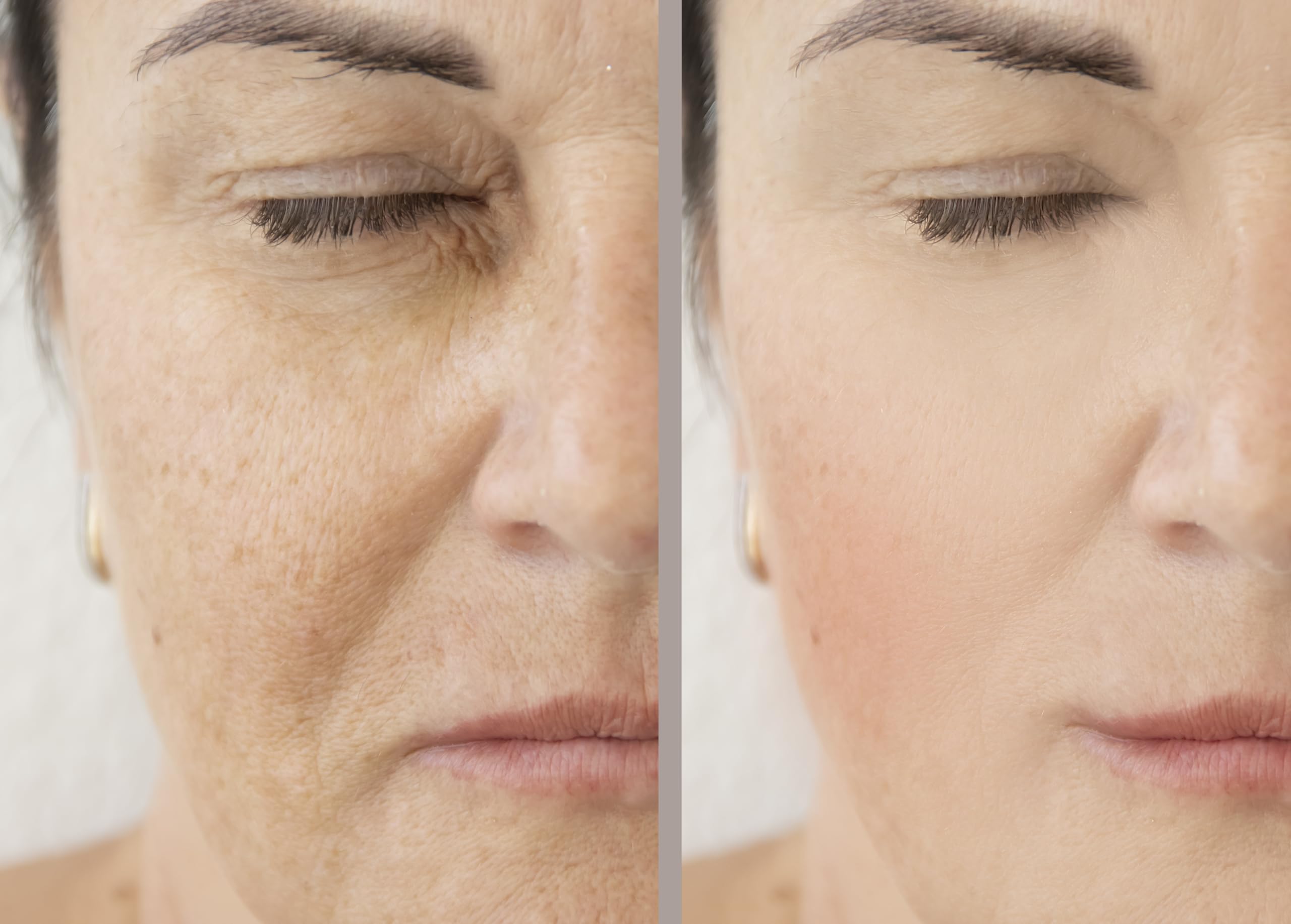 Precision Skin RX Vitality Phloretin C Serum packaging box conveys premium skincare.