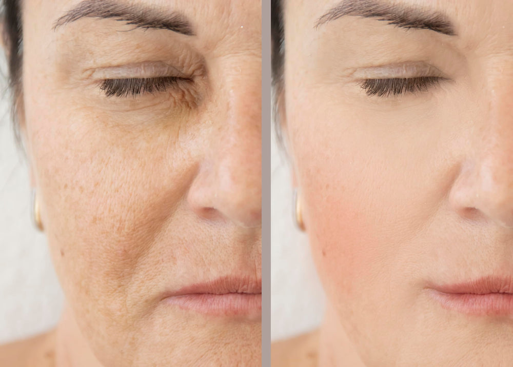 Precision Skin RX Vitality Phloretin C Serum packaging box conveys premium skincare.