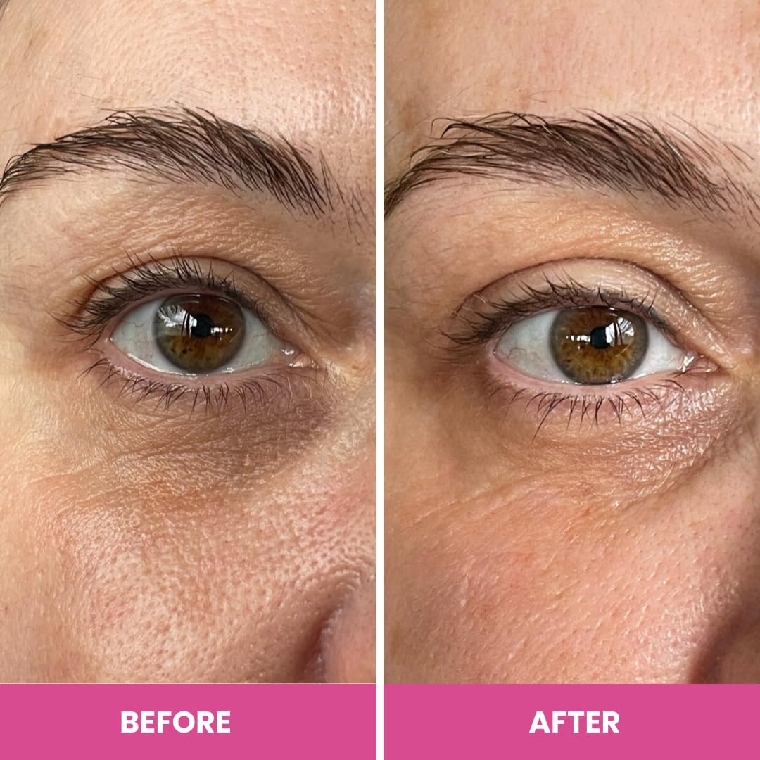 Prime Prometics PrimeEyes Hydrate ingredients panel with five peptides for targeted care.
