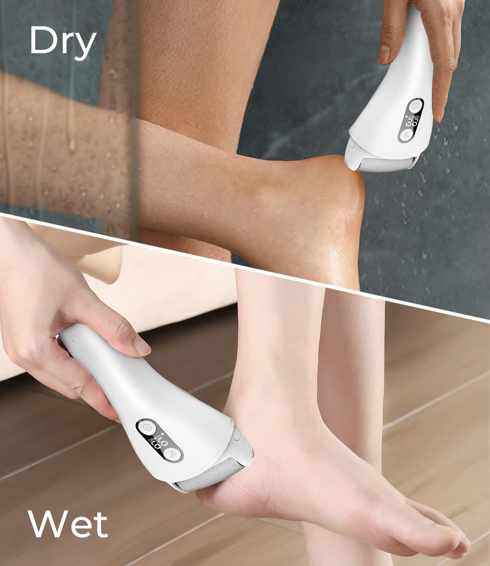 PRITECH pedicure tool in use on heels demonstrates at home care.