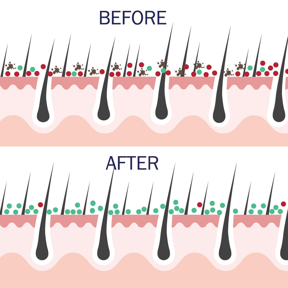 Probiotic Action Clarity in Balance barrier illustration shows strengthened natural defense