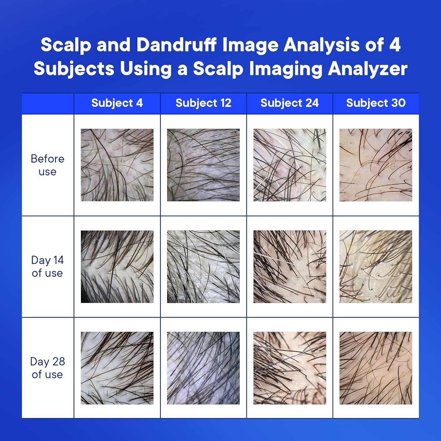 ProBliva bottle being poured for a refreshing scalp cleanse.