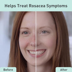 PROcure Rosacare Cleanser foam lather showing light hydration during wash.