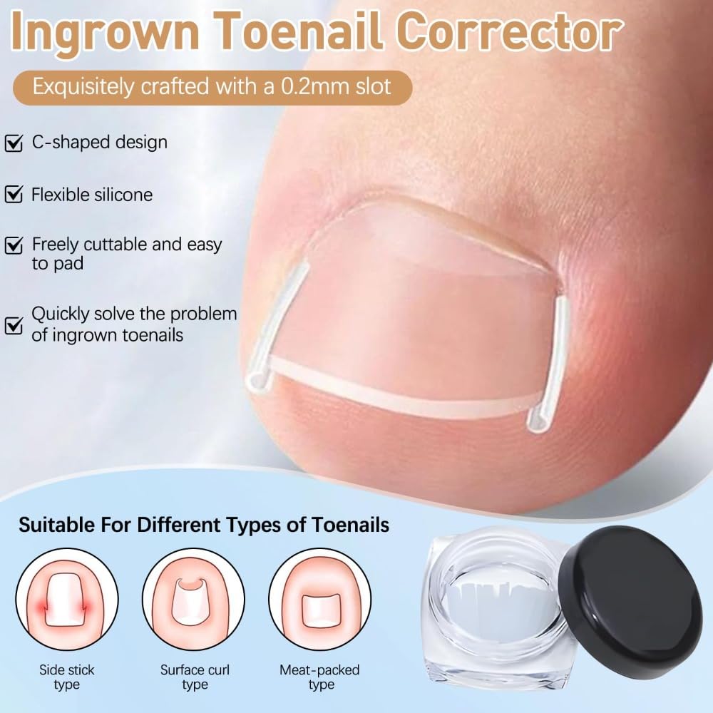 Professional Pedicure Tools ingrown toenail kit breathable design promotes extended wear