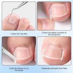 Professional Pedicure Tools ingrown toenail kit curved patches align nails with comfortable wear