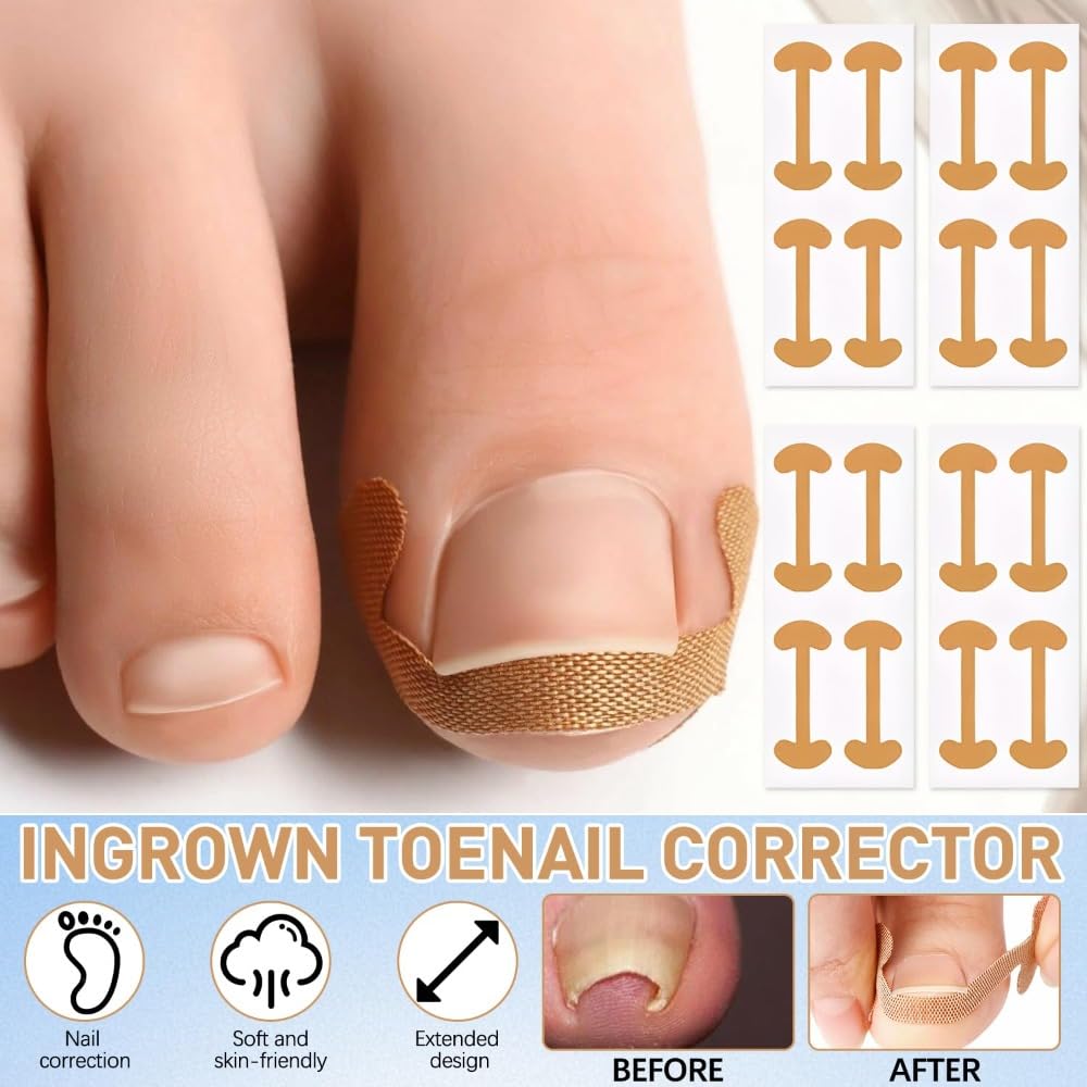 Professional Pedicure Tools ingrown toenail kit precision file supports careful maintenance