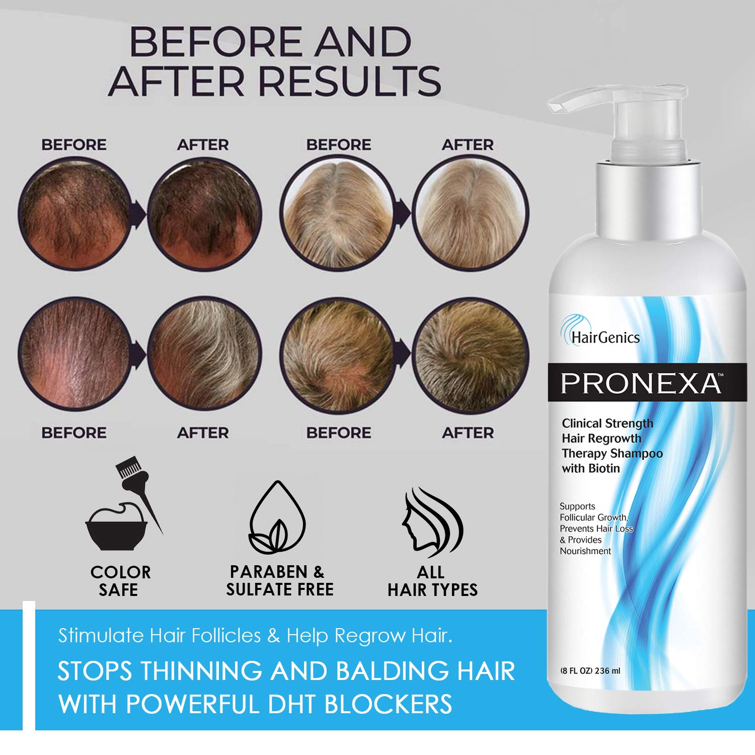 Pronexa Hairgenics clinical-strength shampoo pump ready for easy, consistent use