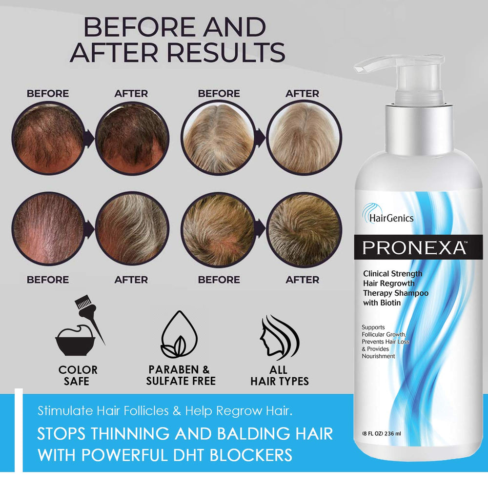 Pronexa Hairgenics clinical-strength shampoo pump ready for easy, consistent use