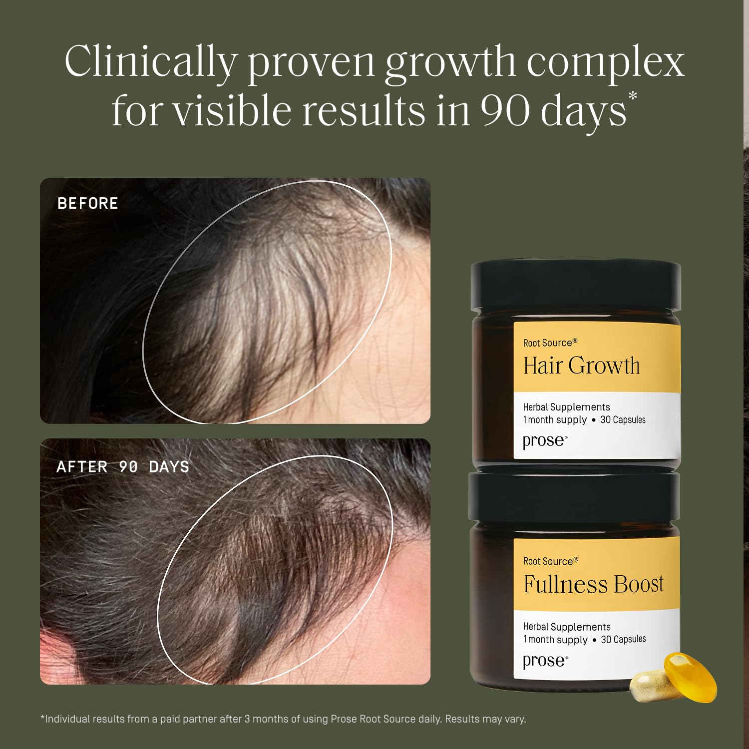Prose capsules close-up highlights a simple daily routine for hair support