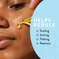 Psoriasis Honey skin serum bottle delivering glow and balanced hydration.