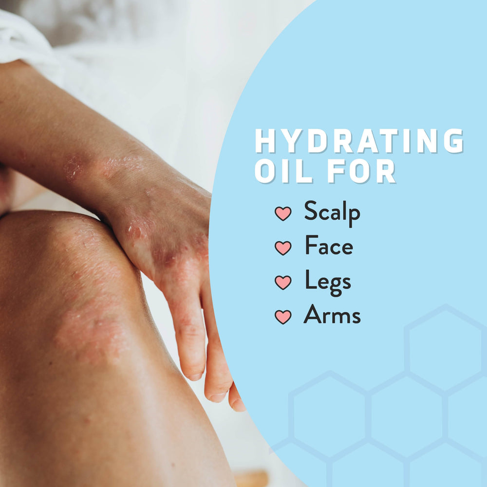 Psoriasis Honey tea tree cooling effect on irritated skin.