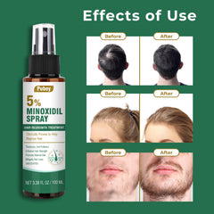 Pugbey minoxidil spray travel pack demonstrates portable care for on-the-go hair support.