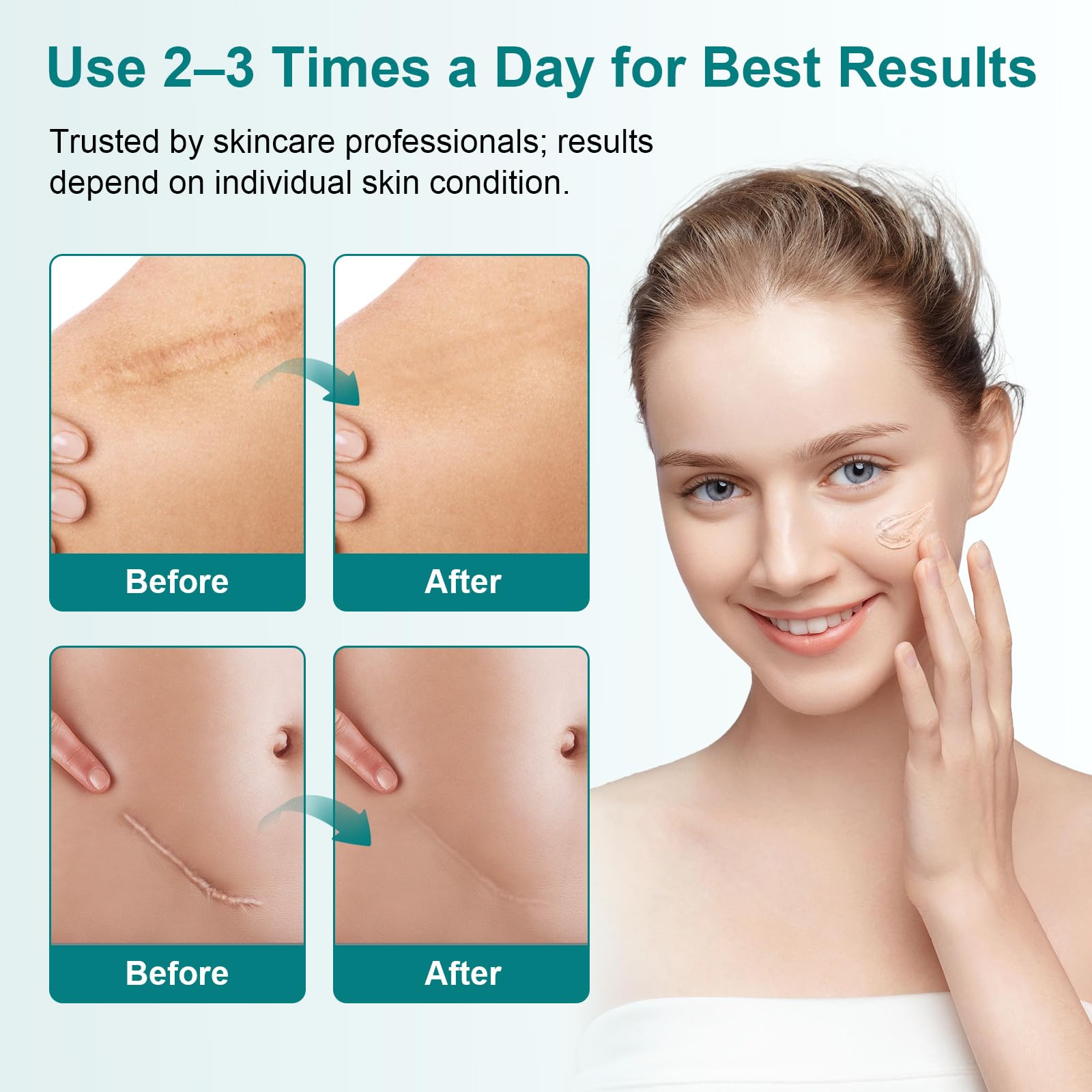 Pumkot Scar Cream lightweight formula absorbs quickly.