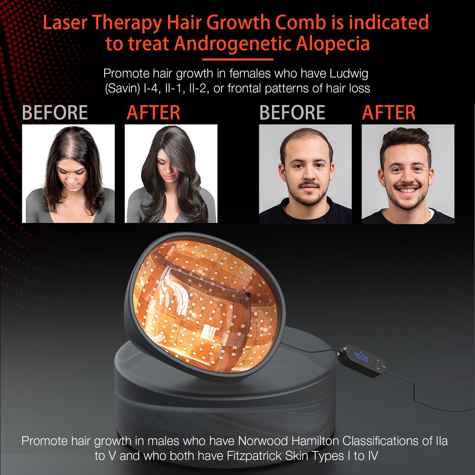 PUPCA Laser Cap dome shape ensures full scalp coverage during treatment.