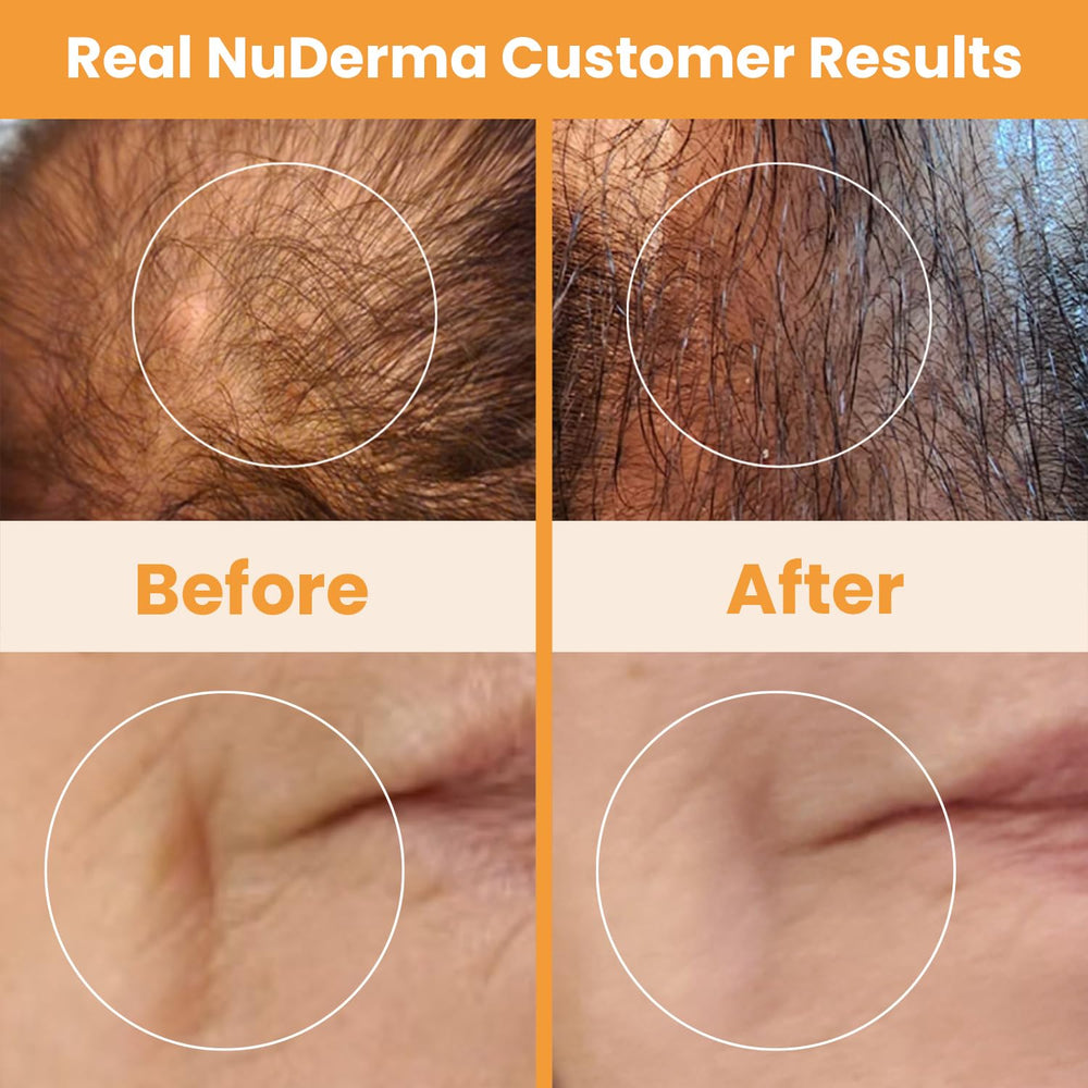 NuDerma treatment guides help plan sessions and maximize ease.