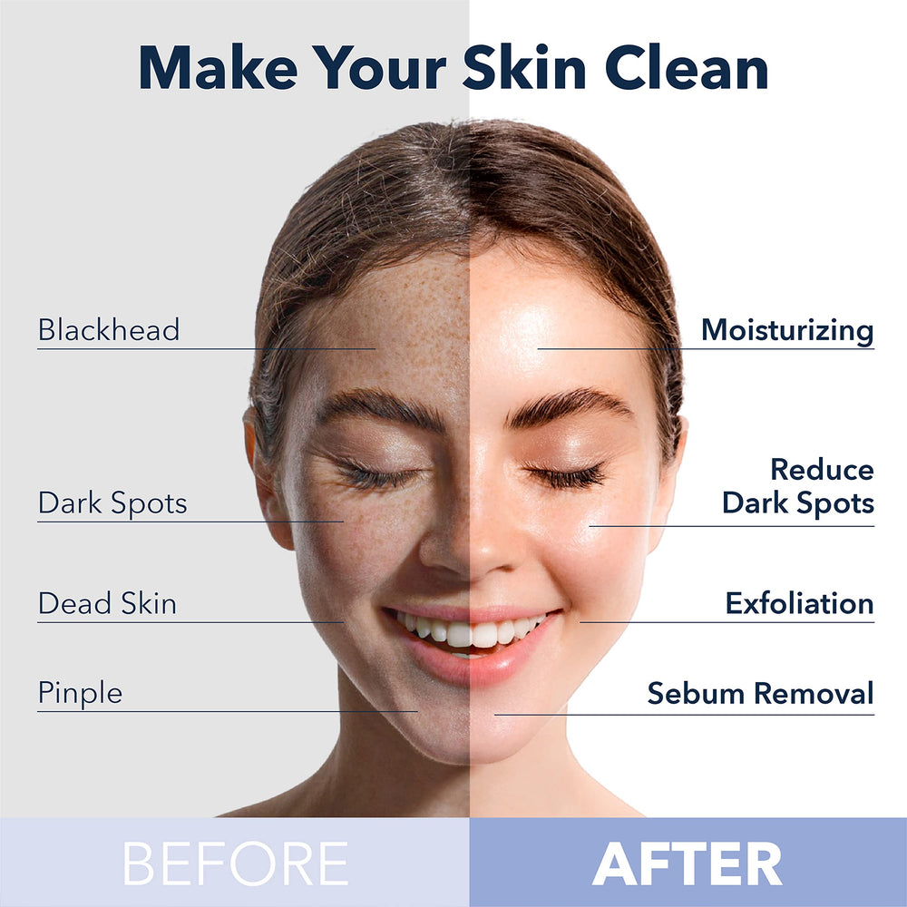 Purederm Peach O2 Bubble Mask in use, bubbles rising for gentle exfoliation.